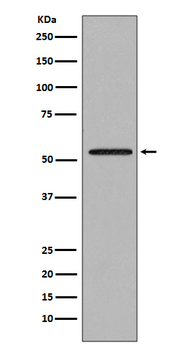 Smad2 Rabbit mAb [KD Validated]
