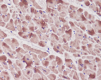 Troponin I Rabbit mAb Antibody