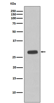 Troponin I Rabbit mAb Antibody