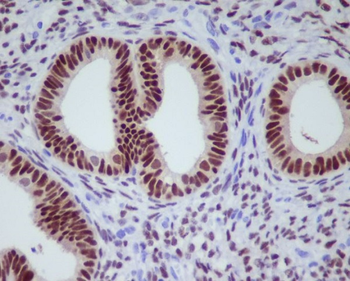Progesterone Receptor Rabbit mAb Antibody