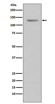 Progesterone Receptor Rabbit mAb Antibody