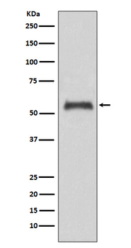 Caspase-8 Rabbit mAb Antibody
