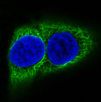 Cytokeratin 10 Rabbit mAb Antibody