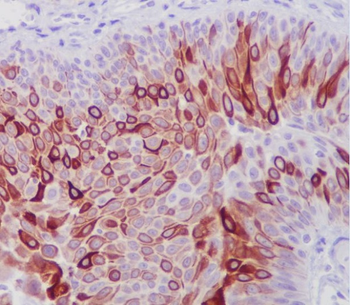 Cytokeratin 10 Rabbit mAb Antibody