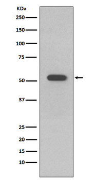 Cytokeratin 10 Rabbit mAb Antibody
