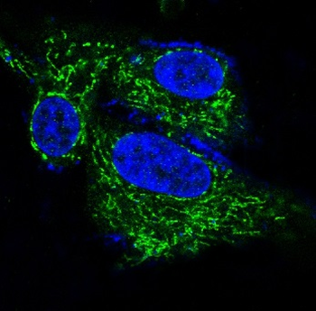 BDNF Rabbit mAb Antibody