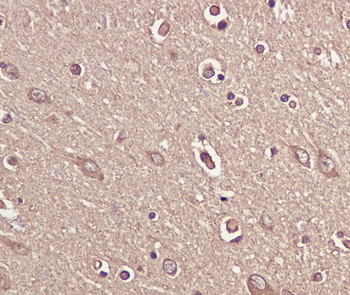 BDNF Rabbit mAb Antibody
