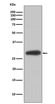 BDNF Rabbit mAb Antibody