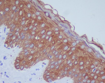 Cytokeratin 14 Rabbit mAb Antibody