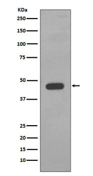 Cytokeratin 14 Rabbit mAb Antibody