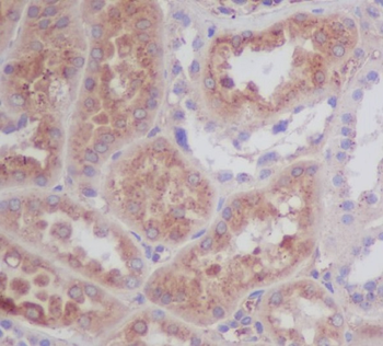 Apolipoprotein E Rabbit mAb Antibody