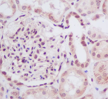 UBE2I Rabbit mAb Antibody