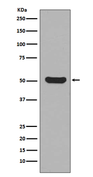 Cytokeratin 16 Rabbit mAb