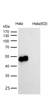 Cyclin E2 Rabbit mAb [KD Validated] Antibody