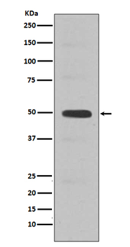 Cyclin E2 Rabbit mAb [KD Validated]