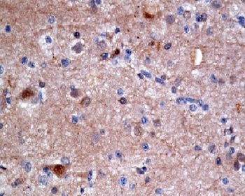 ATP citrate lyase Rabbit mAb  [KD Validated]