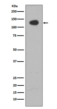 ATP citrate lyase Rabbit mAb  [KD Validated]
