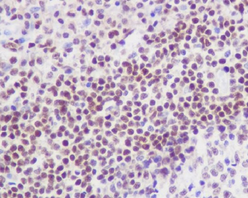 FLI1 Rabbit Monoclonal Antibody