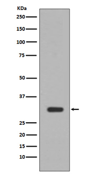PIM1 Rabbit mAb Antibody