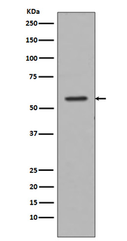 Tyrosine Hydroxylase Rabbit mAb