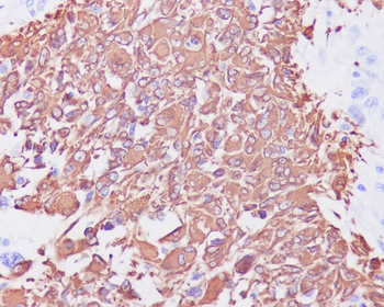 GFAP Rabbit mAb Antibody
