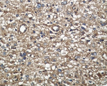 Midkine Rabbit mAb Antibody