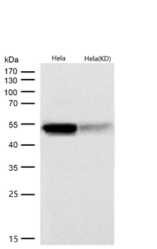 Cytokeratin 7 Rabbit mAb   [KD Validated]