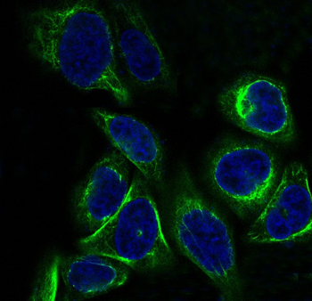 Cytokeratin 7 Rabbit mAb   [KD Validated]