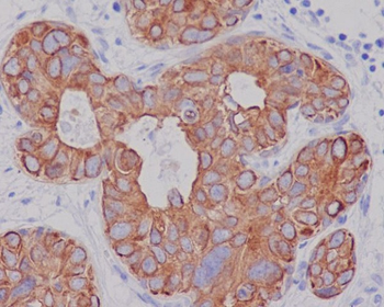 Cytokeratin 7 Rabbit mAb   [KD Validated]