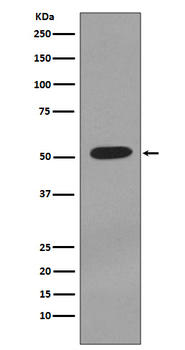 Cytokeratin 7 Rabbit mAb   [KD Validated]