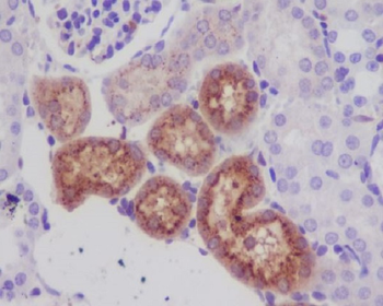 Lysozyme Rabbit mAb Antibody