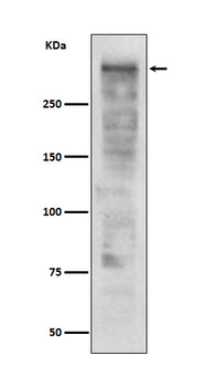 Ki67 Rabbit mAb