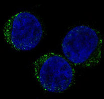 CD8 Rabbit mAb Antibody