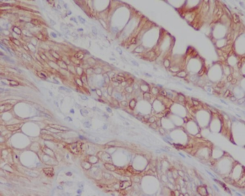 CD8 Rabbit mAb Antibody
