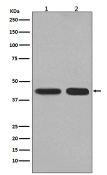 PGK1 Rabbit mAb  [KD Validated]