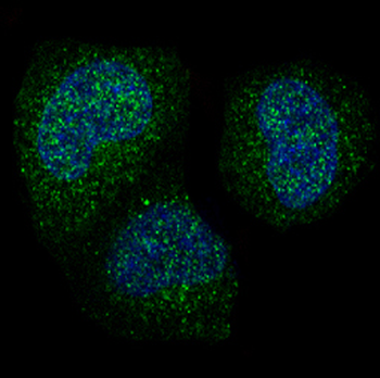 Cyclin B1 Rabbit mAb [KD Validated]