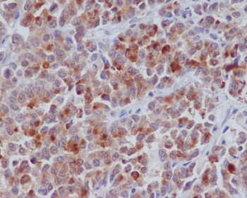Cyclin B1 Rabbit mAb [KD Validated]