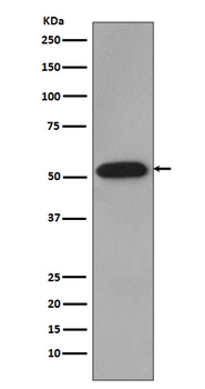 Cyclin B1 Rabbit mAb [KD Validated]