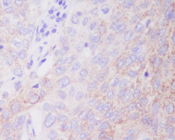 Hexokinase 1 Rabbit mAb [KD Validated]