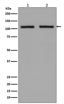 Hexokinase 1 Rabbit mAb [KD Validated]