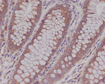 Rab5 Rabbit mAb Antibody