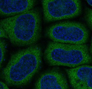 MAP1LC3A Rabbit mAb Antibody