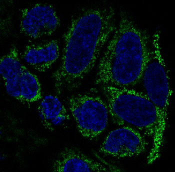 TOMM20 Rabbit mAb Antibody