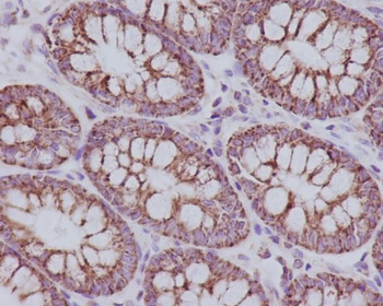 TOMM20 Rabbit mAb Antibody