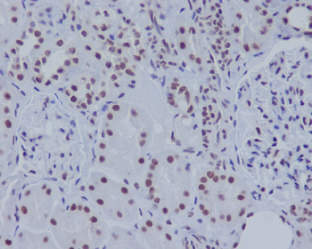 ASH2L Rabbit mAb Antibody