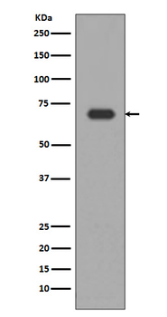 Alas1 Rabbit mAb [KD Validated] Antibody