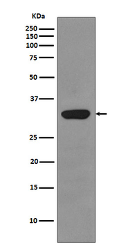 RPS3 Rabbit mAb Antibody