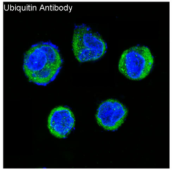 Ubiquitin Rabbit mAb Antibody