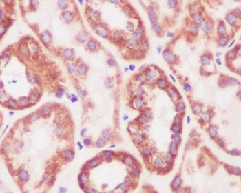 Prohibitin Rabbit mAb Antibody