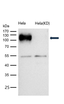 LAMP2 Rabbit mAb [KD Validated] Antibody